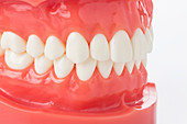 False teeth and gums