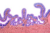 Human gall bladder,light micrograph