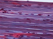 Striated muscle,light micrograph