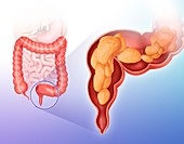 Cross section of intestine,illustration