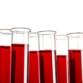 Blood samples in test tubes