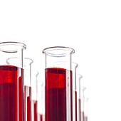 Blood samples in test tubes