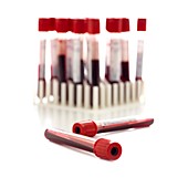 Blood collection tubes