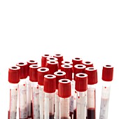 Blood collection tubes