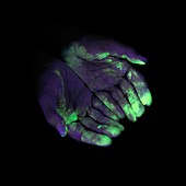 UV light showing bacteria on hands