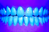 Model teeth in UV light
