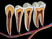 Teeth,cross section,artwork