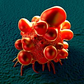 Bowel cancer cell,illustration