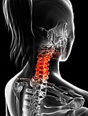 Human cervical spine pain,Illustration