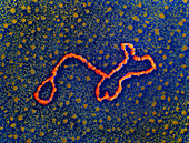 Coloured TEM of a DNA transposon
