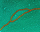 Coloured TEM of DNA replication at bubble stage