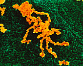 Coloured SEM of single gene transcript of a midge