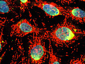 Immunofluorescent LM of recombinant rat cells