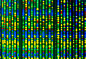 Genome research: autoradiogram of sequenced cDNA