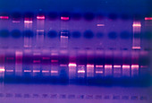 DNA fragments in gel stained with Ethidium Bromide