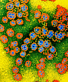 Coloured TEM of experimental Herpes virus vaccine