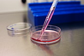 Preparing cell culture