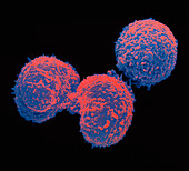 SEM of hybridoma cells