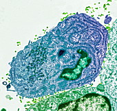 Hybridoma cell,TEM