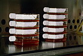 Tissue culture flasks with cancer cells