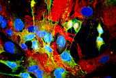 Immunofluorescent LM of HeLa cells in culture