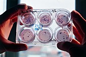 HeLa cultures marked to test cell communication