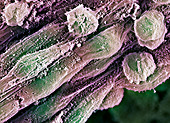 Human embryonic stem cells,SEM