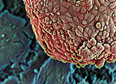 Embryonic stem cells,SEM