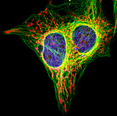 HeLa cells,light micrograph