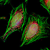 HeLa cells,light micrograph