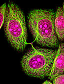 HeLa cells,light micrograph