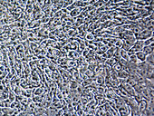 Cystic fibrosis stem cells