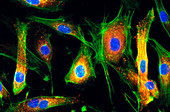 Human endothelial cells,light micrograph