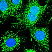 HeLa cells,light micrograph