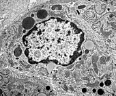 TEM of an epithelial cell