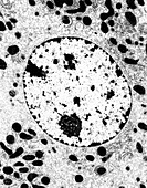 Transmission electron micrograph of cell nucleus