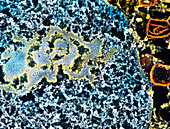 Coloured SEM of nucleolus and chromatin fibres