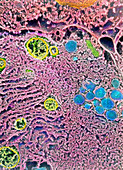 Colour SEM of endoplasmic reticulum in Leydig cell