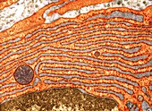 Rough endoplasmic reticulum,TEM