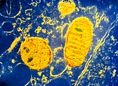 False-colour TEM of mitochondrion in rat sperm
