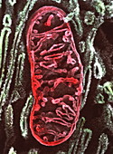 SEM of mitochondrion