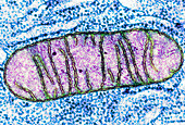 Mitochondrion,TEM