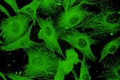 Cell microtubules/cytoskeleton