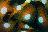 Immunofluorescent LM of the cytoskeleton of cells