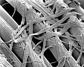 SEM of lyocell (synthetic cellulose) fibres