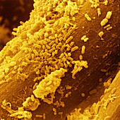 False-col SEM of bacteria on a used kitchen pad