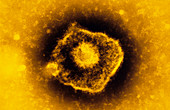 Coloured TEM of Varicella-zoster virus