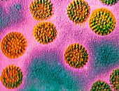 False-col TEM of rotaviruses