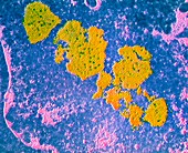 False colour TEM of papilloma virus