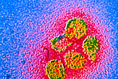 TEM of virions of yellow fever virus